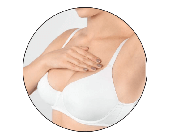 breast implant