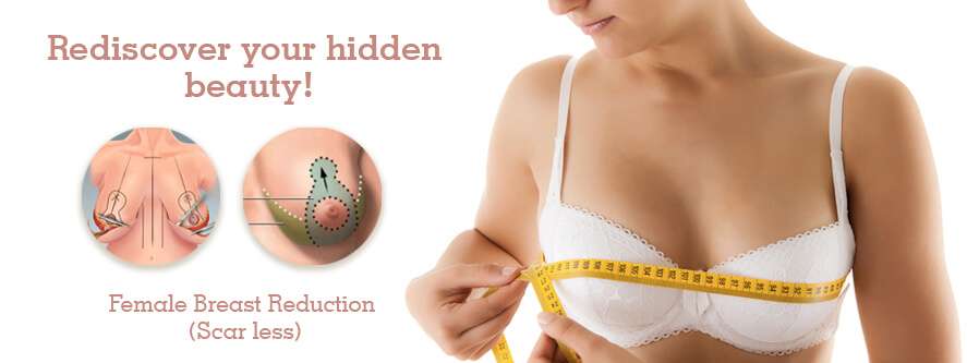 Female breast reduction